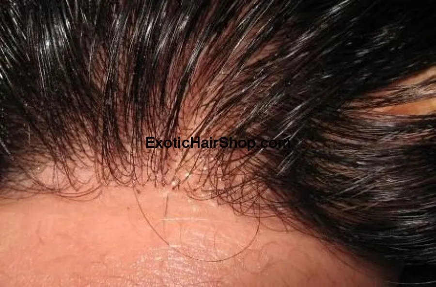 HD Thin Lace Closure - 6x6